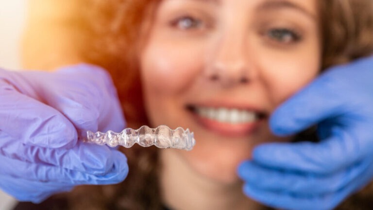 cosa fare in caso di denti storti