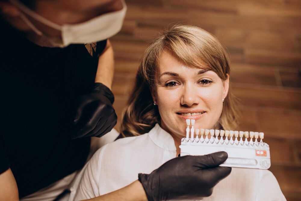 quanto durano le faccette ai denti